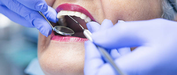 Best Emergency Wisdom Teeth Removal in Rden City, GA
